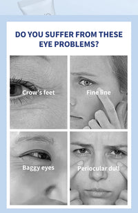 (NEW) O'CHEAL Electric Massaging Anti-Aging Eye Cream